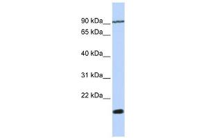 TM4SF4 antibody used at 1 ug/ml to detect target protein.