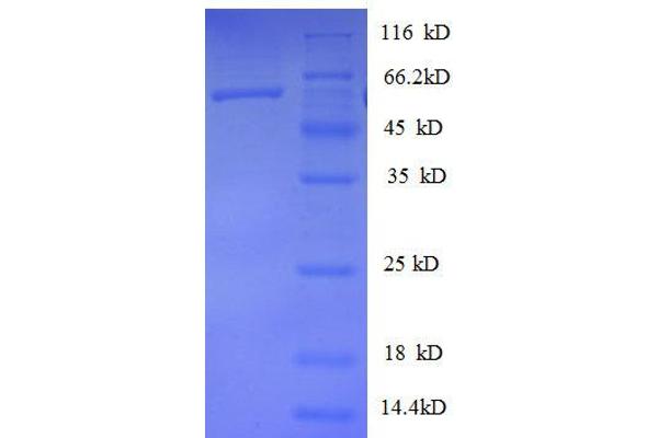 HNRNPD/AUF1 Protein (AA 18-355, partial) (GST tag)