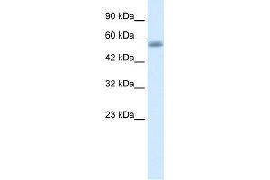 WB Suggested Anti-C16ORF44 Antibody Titration:  1. (KLHL36 Antikörper  (N-Term))