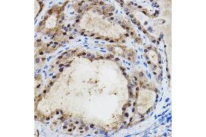 Immunohistochemistry (IHC) image for anti-Endothelial PAS Domain Protein 1 (EPAS1) (AA 588-870) antibody (ABIN6141764)