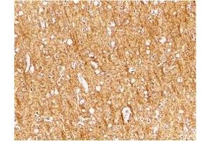Immunohistochemistry (IHC) image for anti-ATR serine/threonine kinase (ATR) (Middle Region) antibody (ABIN1030871) (ATR Antikörper  (Middle Region))
