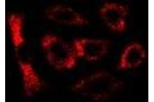 Immunofluorescent analysis of LC3B staining in U2OS cells. (LC3B Antikörper)