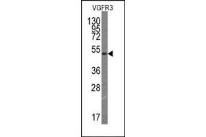 Western Blotting (WB) image for anti-Fms-Related Tyrosine Kinase 4 (FLT4) antibody (ABIN356407) (FLT4 Antikörper)