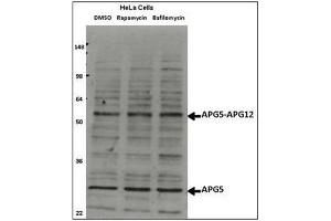 Western Blotting (WB) image for anti-ATG5 Autophagy Related 5 (ATG5) (AA 1-30), (N-Term) antibody (ABIN1449605)