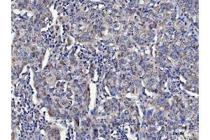 IHC analysis of TOLLIP using anti-TOLLIP antibody (ABIN7599202).