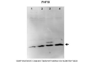Lanes:   1. (PHF19 Antikörper  (C-Term))