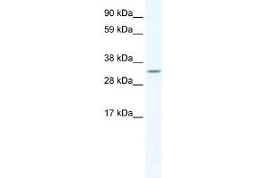 WB Suggested Anti-APEX1 Antibody Titration:  1. (APEX1 Antikörper  (N-Term))