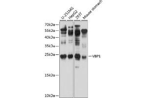 Western blot analysis of extracts of various cell lines, using VBP1 antibody (ABIN6129700, ABIN6150068, ABIN6150069 and ABIN6224846) at 1:1000 dilution. (VBP1 Antikörper  (AA 1-197))