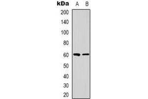 Western blot analysis of NRBP1 expression in Jurkat (A), HepG2 (B) whole cell lysates. (NRBP1 Antikörper)