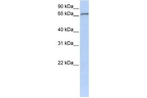 WB Suggested Anti-ZNF41 Antibody Titration:  0. (ZNF41 Antikörper  (C-Term))