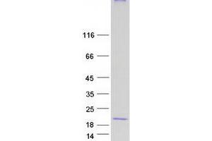 Validation with Western Blot (MAL Protein (Transcript Variant D) (Myc-DYKDDDDK Tag))