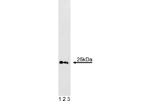 Western Blotting (WB) image for anti-RAB5A, Member RAS Oncogene Family (RAB5A) (AA 1-215) antibody (ABIN967882)