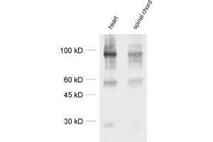 anti-Nicotinic Acetylcholine Receptor beta (CHRNB1) antibody