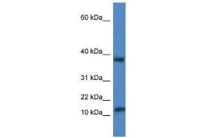 Western Blot showing Vamp1 antibody used at a concentration of 1.