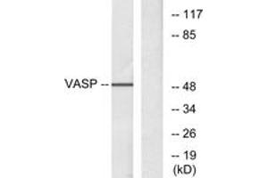 Western blot analysis of extracts from NIH-3T3 cells, treated with forskolin 40myM 30', using VASP (Ab-157) Antibody.