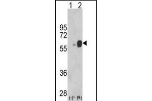 Western blot analysis of ARSB (arrow) using rabbit polyclonal ARSB Antibody (Center) (ABIN652346 and ABIN2841582). (Arylsulfatase B Antikörper  (AA 235-266))