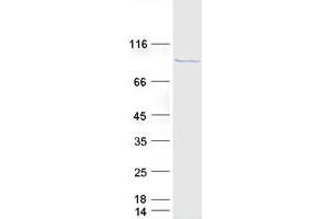 Western Blotting (WB) image for DEAD (Asp-Glu-Ala-Asp) Box Polypeptide 21 (DDX21) protein (Myc-DYKDDDDK Tag) (ABIN2719279)