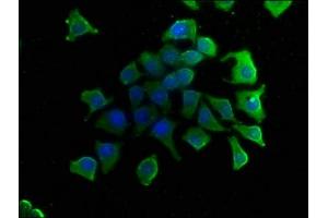 Immunofluorescence staining of A549 cells with ABIN7153457 at 1:50, counter-stained with DAPI. (GAL4 Antikörper  (AA 1-323))