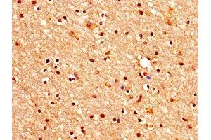 IHC image of ABIN7160347 diluted at 1:400 and staining in paraffin-embedded human brain tissue performed on a Leica BondTM system. (CHRM3 Antikörper  (AA 253-492))