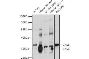 Western blot analysis of extracts of various cell lines, using CB antibody (ABIN7266072) at 1:1000 dilution. (CA5B Antikörper  (AA 1-317))