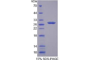 Image no. 1 for Laminin, beta 4 (LAMb4) (AA 1543-1759) protein (His tag) (ABIN6238474) (LAMb4 Protein (AA 1543-1759) (His tag))