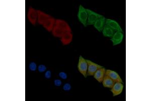 ABIN6259466 and ABIN6275441 staining Hela cells(45 min of heat-shock) by IF/ICC. (RFTN1 Antikörper  (Internal Region))