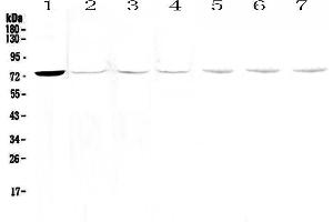 Western blot analysis of Tec  using anti-Tec  antibody . (NR4A3 Antikörper)