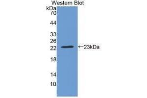 Detection of Recombinant CRYbB2, Rat using Monoclonal Antibody to Crystallin Beta B2 (CRYbB2)