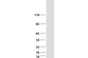 Western Blotting (WB) image for Vacuolar Protein Sorting 36 (VPS36) protein (Myc-DYKDDDDK Tag) (ABIN2735426)