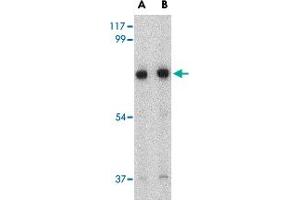 Western blot analysis of HAP1 in mouse brain tissue lysate with HAP1 polyclonal antibody  at (A) 0.
