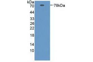 Detection of Recombinant ZPI, Human using Polyclonal Antibody to Serpin A10 (SERPINA10) (SERPINA10 Antikörper  (AA 24-444))