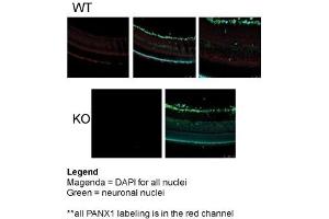 Immunohistochemistry (IHC) image for anti-Pannexin 1 (PANX1) (Middle Region) antibody (ABIN2775573)