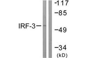 Western blot analysis of extracts from K562 cells, using IRF3 (Ab-385) Antibody. (IRF3 Antikörper  (AA 351-400))
