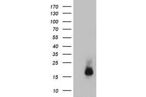 Image no. 1 for anti-Cystatin C (CST3) antibody (ABIN1497754) (CST3 Antikörper)