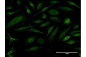 Immunofluorescence of monoclonal antibody to EIF1AY on HeLa cell. (EIF1AY Antikörper  (AA 31-120))