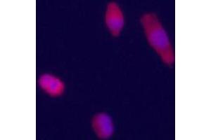 Immunofluorecence staining of GPC3 polyclonal antibody  on HepG2 cells . (Glypican 3 Antikörper  (Internal Region))
