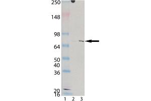 Western blot analysis of KIM-1 (human), mAb (3F4) : Lane 1: MW marker, Lane 2: HeLa, (cell lysate) , Lane 3: CaKi-2 (cell lysate). (HAVCR1 Antikörper)