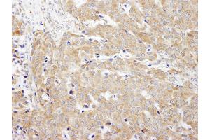 Immunohistochemistry (IHC) image for anti-Carbamoyl-Phosphate Synthetase 2, Aspartate Transcarbamylase, and Dihydroorotase (CAD) (AA 1650-1700) antibody (ABIN7453823)