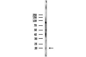 Western blot analysis of lysates from LoVo cells(heat-shock,45 min treatment), using RPL35 Antibody at 1/1000 dilution.