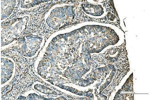 IHC analysis of CD9 using anti-CD9 antibody (ABIN7600001). (CD9 Antikörper  (AA 139-192))