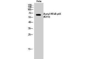 Western Blotting (WB) image for anti-Nuclear Factor-kB p65 (NFkBP65) (acLys310) antibody (ABIN3181877) (NF-kB p65 Antikörper  (acLys310))