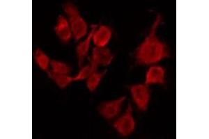 ABIN6267494 staining Hela by IF/ICC. (SREBF1 Antikörper  (pSer439))