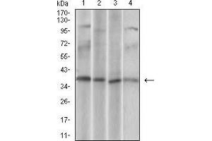 Western Blotting (WB) image for anti-CD68 Molecule (CD68) (AA 42-155) antibody (ABIN2682982)