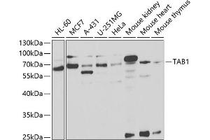 Western blot analysis of extracts of various cell lines, using T antibody (ABIN6131955, ABIN6148795, ABIN6148796 and ABIN6221421) at 1:1000 dilution. (TAB1 Antikörper  (AA 205-504))