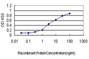 Detection limit for recombinant GST tagged GCK is approximately 0. (GCK Antikörper  (AA 356-465))