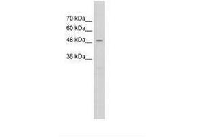 Image no. 2 for anti-RAD23 Homolog A (RAD23A) (AA 201-250) antibody (ABIN203508) (RAD23A Antikörper  (AA 201-250))