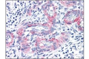 Immunohistochemistry (IHC) image for anti-Melanoma Cell Adhesion Molecule (MCAM) antibody (ABIN614548) (MCAM Antikörper)
