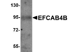 Western Blotting (WB) image for anti-EF-Hand Calcium Binding Domain 4B (EFCAB4B) (C-Term) antibody (ABIN1030378)
