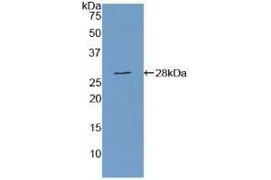 Detection of Recombinant CSE, Human using Polyclonal Antibody to Cystathionine (CTH) (Cystathionine (AA 163-382) Antikörper)