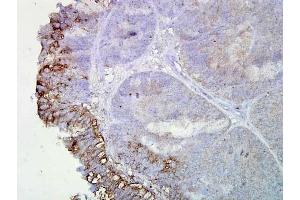 Hsp90 (AC-16), Human Colon Cancer 1 in 2000, Amplifier (HSP90 Antikörper)